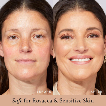 Blur tinted moisturizer SPF 30 - instantly brightens, hydrates & smooths your skin