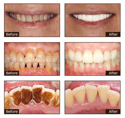 🏆 Nicotinamide Toothpaste【💎New upgrade Powerful type  10% concentration of Nicotinamide】